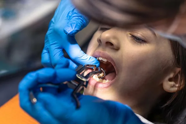 Extractions