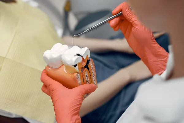Root Canal Treatment